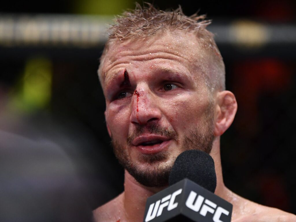 T.J. Dillashaw: Anthony Smith saknar vad som krävs för att bli UFC-mästare